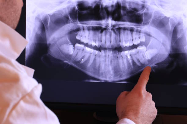 Best Dentist for Tooth Abscess  in Woodworth, LA